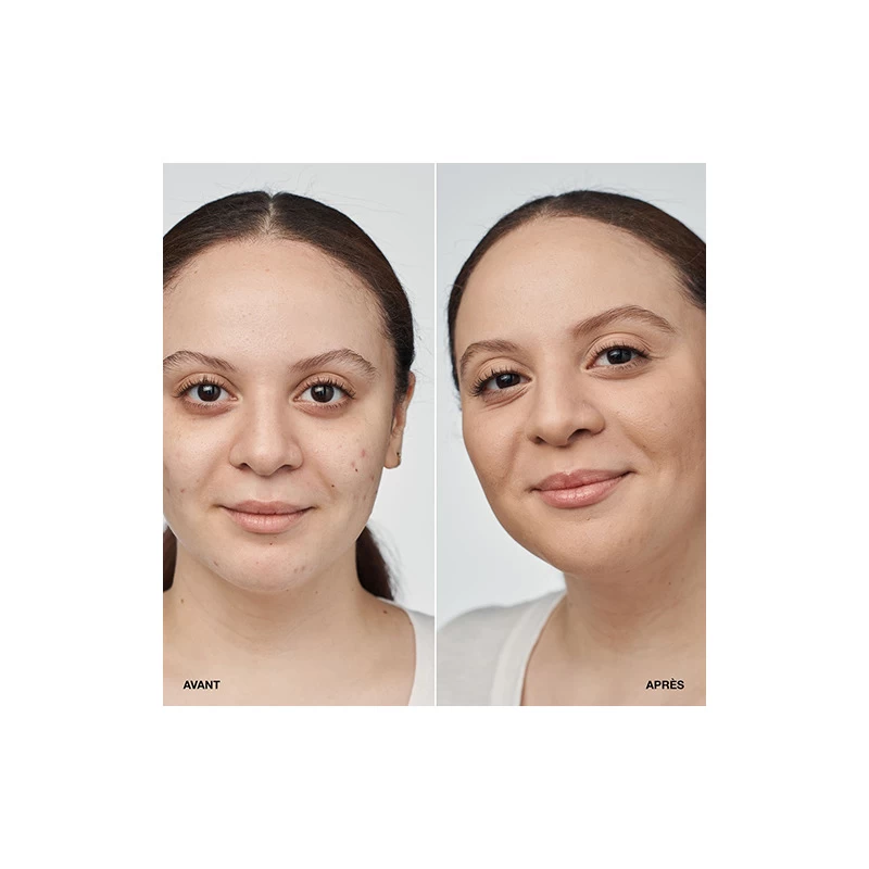 Clinique Even Better Clinical Serum Foundation - Fond De Teint Sérum SPF 20 3 Clinique Even Better Clinical Serum Foundation - Fond De Teint Sérum SPF 20 – Image 3