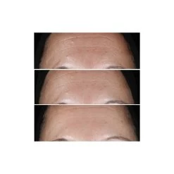 Clinique Smart Clinical Repair Serum - Sérum Correcteur Anti-Rides -Maquillage Et Soins Boutique smart clinical repair serum serum correcteur anti rides 5