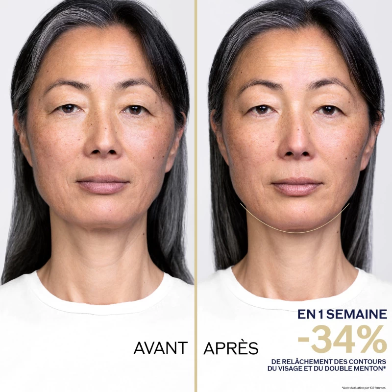 Shiseido Vital Perfection - Concentré Nuit Eclat Contours Redéfinis 3 Shiseido Vital Perfection - Concentré Nuit Eclat Contours Redéfinis – Image 3